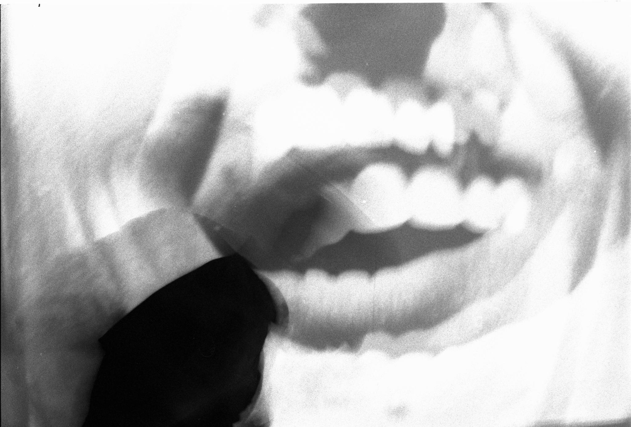 Glossolalia 14
